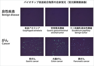 超早期がんリスク検査「プロテオ」（2週間）