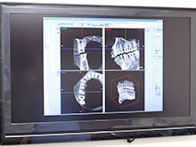 特徴6：歯科用CTによる正確な診査診断が可能