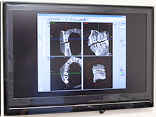 充実した設備と確かな実績を元にしたインプラント治療