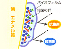 細菌は3～4ヶ月で育ちます～「PMTC」のすすめ～