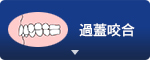 過蓋咬合