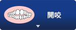 開咬
